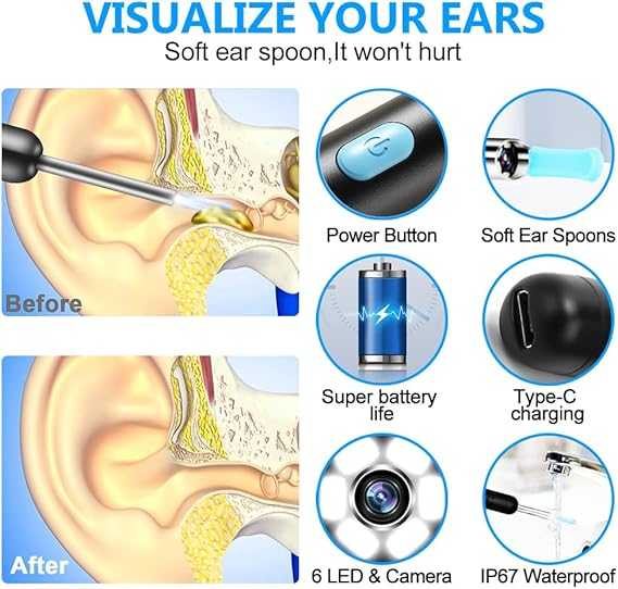 Smart Visual Ear Cleaner – HD Camera Ear Wax Removal Tool with LED Light for Safe & Easy Ear Cleaning