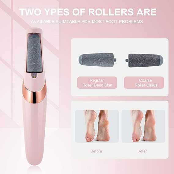 USB Rechargeable Foot Callus Remover – Electric Foot File with LED Light, 2-Speed Settings & Dead Skin Removal for Smooth Feet